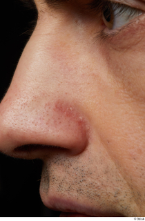 HD Face skin references Josh Hart nose skin pores skin…